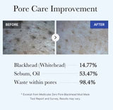 Medicube Zero Pore Blackhead Mud Mask 100g